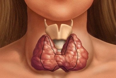 щитовидная железа у женщин